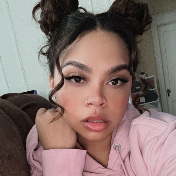 raydimples